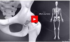 PATIENT EDUCATION VIDEOS